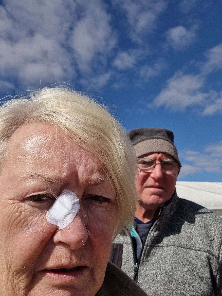 To get Christine's stitches out.